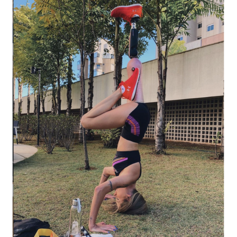 Paola reconhece que o acesso que ela tem a pr&oacute;teses de excelente qualidade est&aacute; distante da realidade de muitos brasileiros