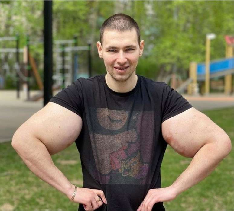 Kirill Tereshin corre risco de morte após seu bíceps romper durante uma luta (Foto: Reprodução/Instagram)