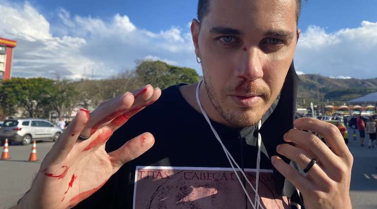 O repórter-cinematográfico Leandro Matozo ensanguentado após ser agredido por um professor bolsonarista
