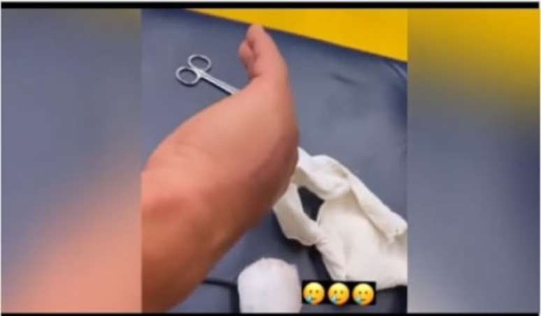 Hulk fez uma postagem nas redes sociais mostrando o "estrago" na mão após pisão de jogador do Fortaleza-(Reprodução/Instagram Hulk)