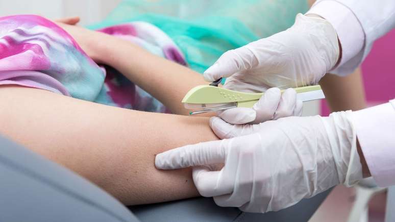 Endocrinologista alerta para possíveis perigos decorrentes do uso do chip da beleza