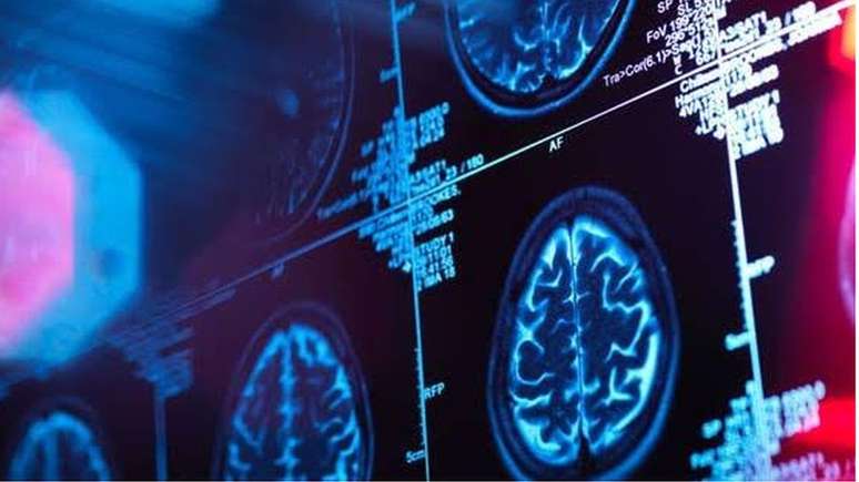 Beta-amiloide pode agir como uma esp&eacute;cie de microbicida que combate os pat&oacute;genos do c&eacute;rebro