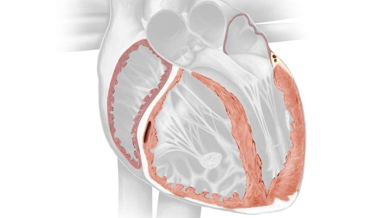 Músculo do coração chamado miocárdio