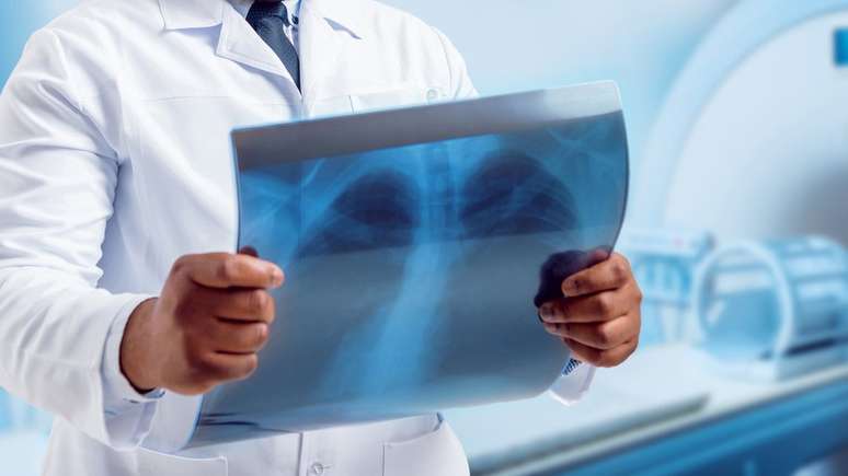 Exames de imagem convencionais, como a radiografia, muitas vezes não detectam essas lesões pulmonares