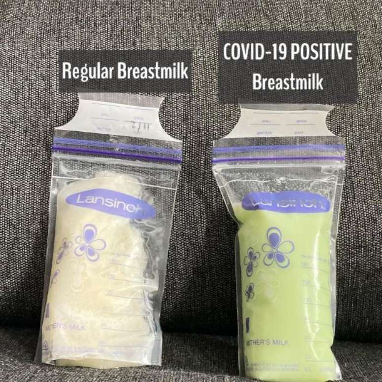 A foto do leite materno com cor esverdeada circulou pela internet: médico explica que não tem relação com anticorpos contra covid-19 (Foto: Reprodução/ Instagram)