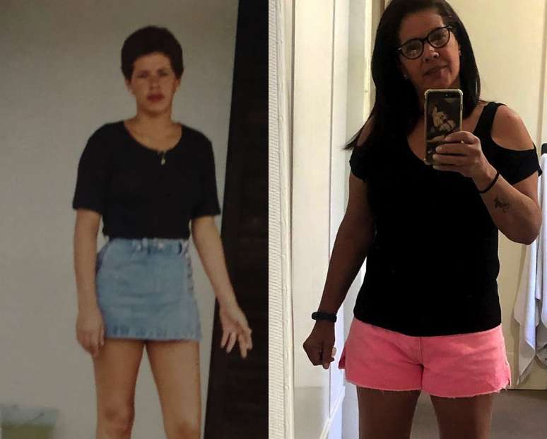 Silvana Madeira, hoje com 56 anos, buscou ajuda médica aos 19 para entender por que, com 1,63m, não conseguia pesar mais do que 49 quilos