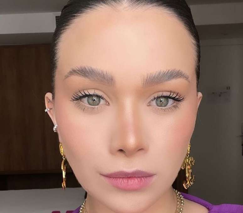 Fl&aacute;via optou por retirar o preenchimento labial e refazer o procedimento |