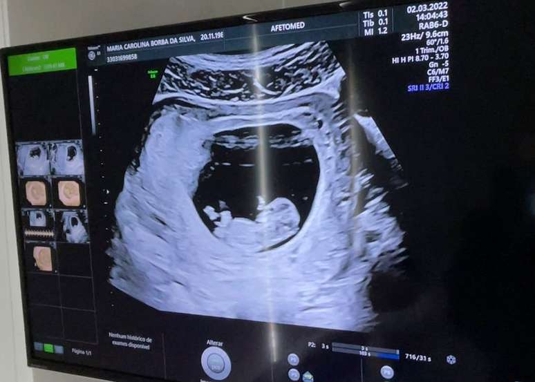 &ldquo;Oi, titias, j&aacute; tenho bracinhos e perninhas&rdquo;: Carol Borba compartilhou imagem do ultrassom (Reprodu&ccedil;&atilde;o/ Instagram)
