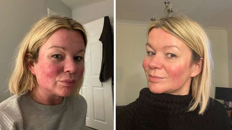 Para Nicola Dalby, o suporte online foi como uma 't&aacute;bua de salva&ccedil;&atilde;o'