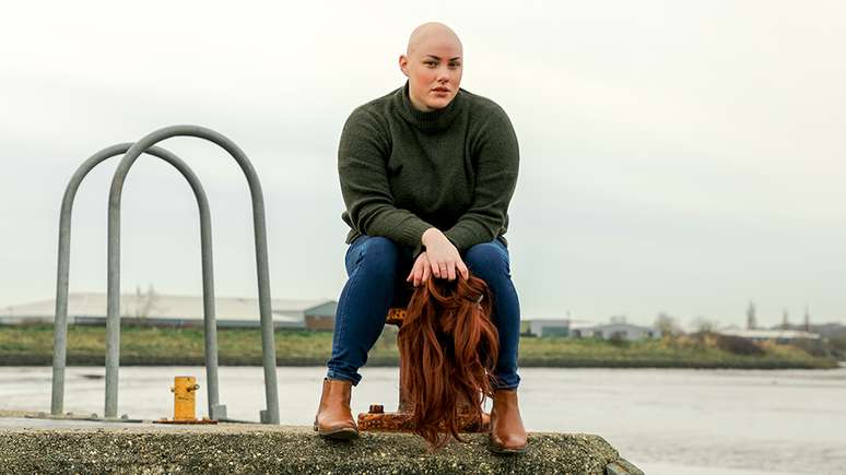 Laura Mathias espera que o legado do conflito no Oscar gere mais aceitação à alopecia.