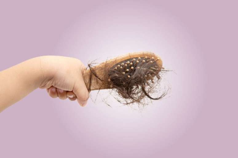 alopecia-crianca