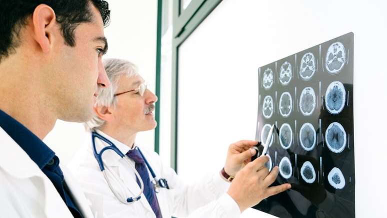 Médicos observam scanner cerebral