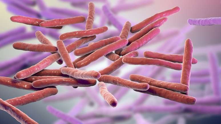 A hanseníase é causada pelo bacilo Mycobacterium leprae