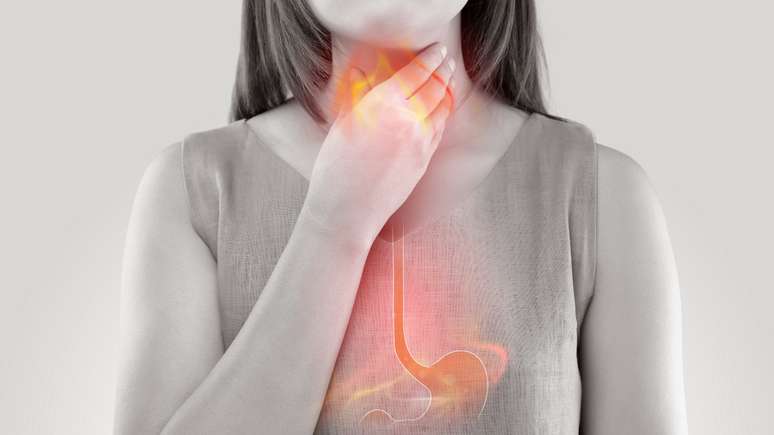 Descubra o que causa o refluxo gastroesofágico
