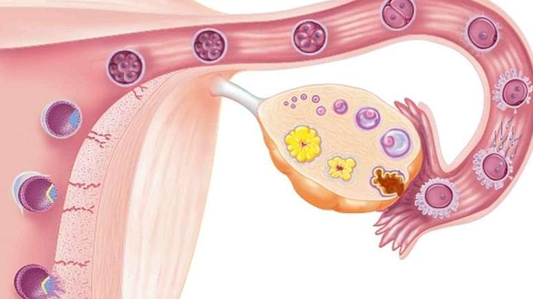 O óvulo é fecundado na trompa uterina (à direita) e se desloca até o útero (à esquerda), onde o embrião se desenvolve