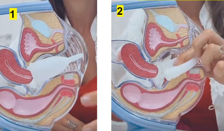 2- Na hora de retirar, uma dica &eacute; usar o dedo para apertar levemente o objeto e diminuir o v&aacute;cuo