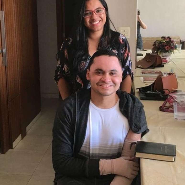 Daniel com sua amiga Andréa, com curativos nos braços após sair do hospital; eles hoje ajudam maranhenses vítimas de queimaduras