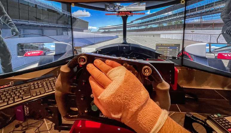 Jimmie Johnson passou por cirurgia na m&atilde;o direita 