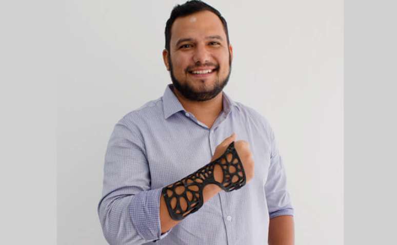 Felipe Neves, cofundador da Fix it, aposta na impressão 3D para órteses 