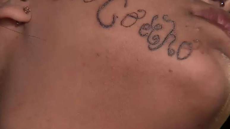 Jovem teria tatuado o seu nome no rosto de ex-namorada