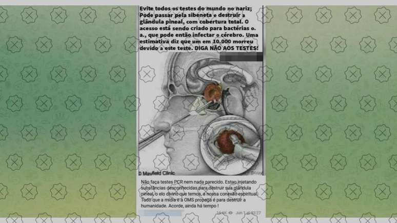 Postagens enganam ao dizer que testes RT-PCR podem danificar glândula pineal