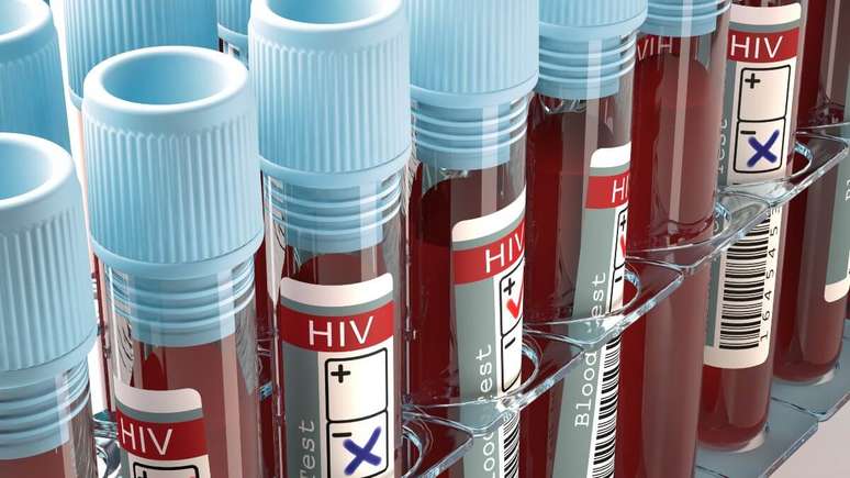 Entenda a nova variante do HIV
