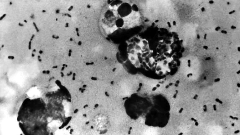 A bactéria 'Yersinia pestis' é a causadora da peste bubônica