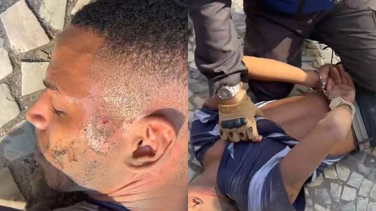 Jovem imobilizado por policial tem marcas de agressão no rosto