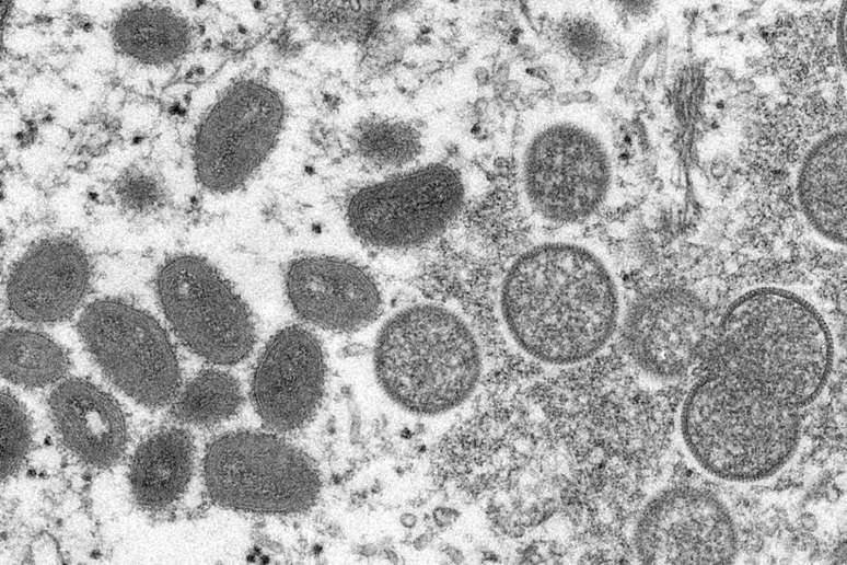 Imagem de microscópio eletrônico mostra sinais da varíola dos macacos em uma amostra de pele humana