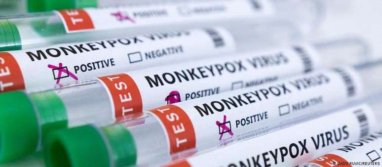 Brasil já registra 17 casos de varíola dos macacos