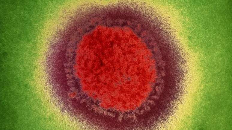 Vírus da influenza, causador da gripe, praticamente desapareceu no início da pandemia, surpreendendo pesquisadores