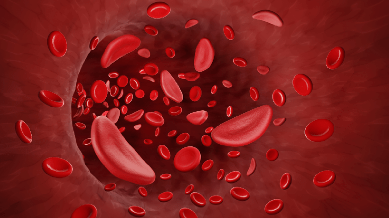 Anemia: conheça os tipos e as causas da síndrome anêmica