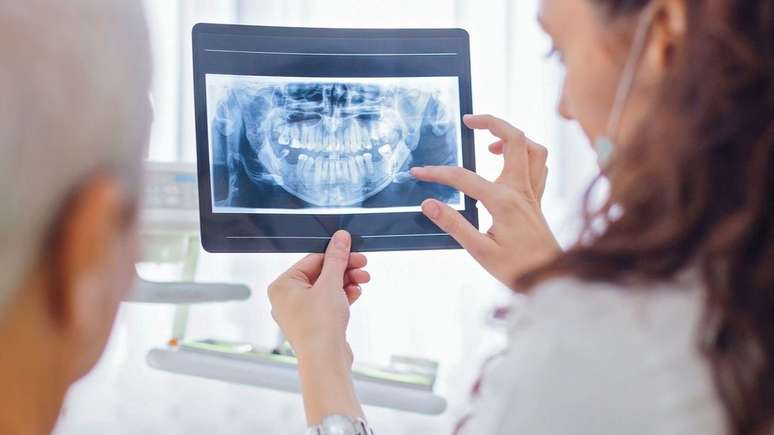 Parte do risco da periodontite é que ela não é detectada em muitos pacientes, pois normalmente não apresenta sintomas