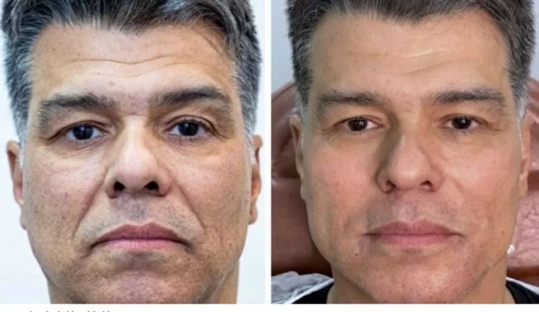 Antes e depois do ator e cantor Maurício Mattar, de 58 anos