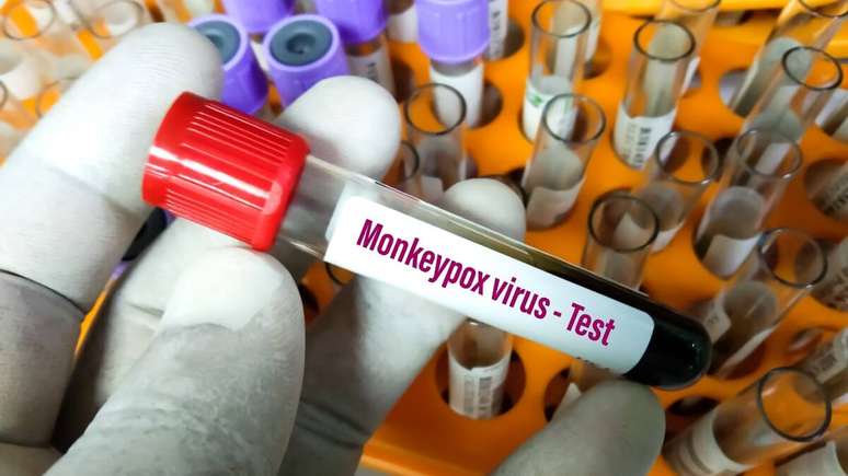 Sintomas da varíola dos macacos