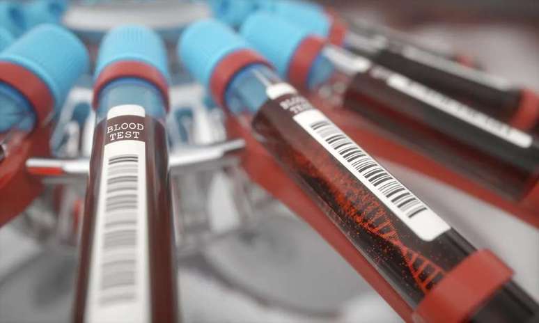 Novo tipo de exame de sangue pode ser alternativa para o diagnóstico de câncer de mama (Imagem: Ktsimage/Envato)