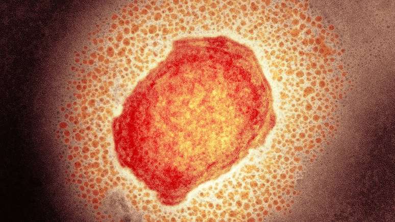 Partícula do vírus da varíola dos macacos; OMS detectou cerca de 80 casos em 12 países
