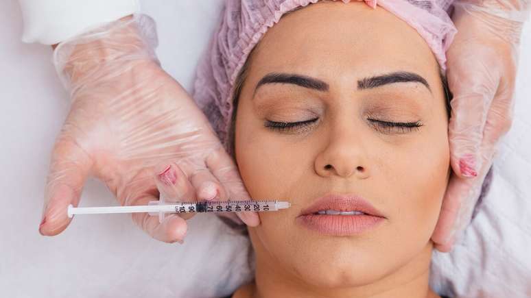 Botox: especialistas explicam como evitar desconforto ao sorrir