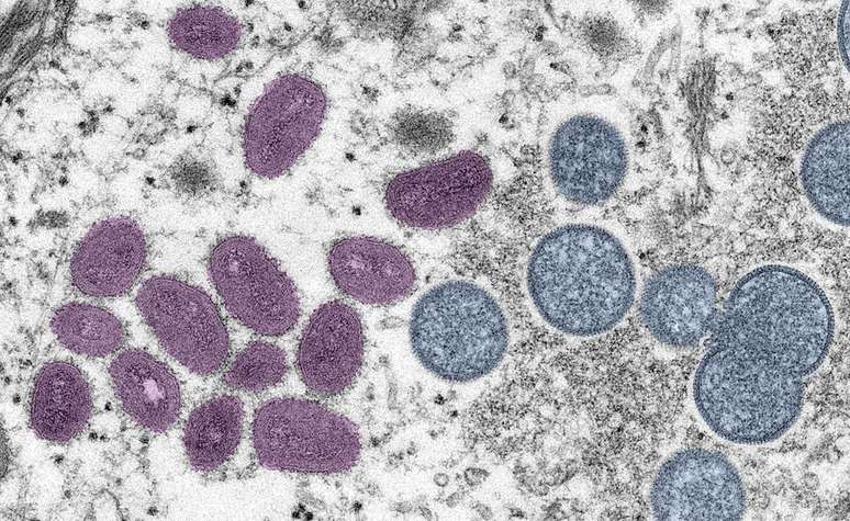 Imagem de microscopia eletrônica (EM) colorida digitalmente representando fragmentos do vírus da varíola de macaco