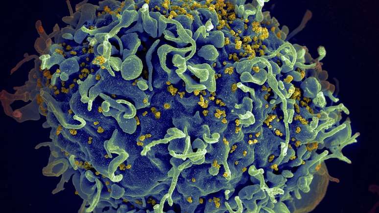 Eletromicrografia mostra HIV infectando célula humana