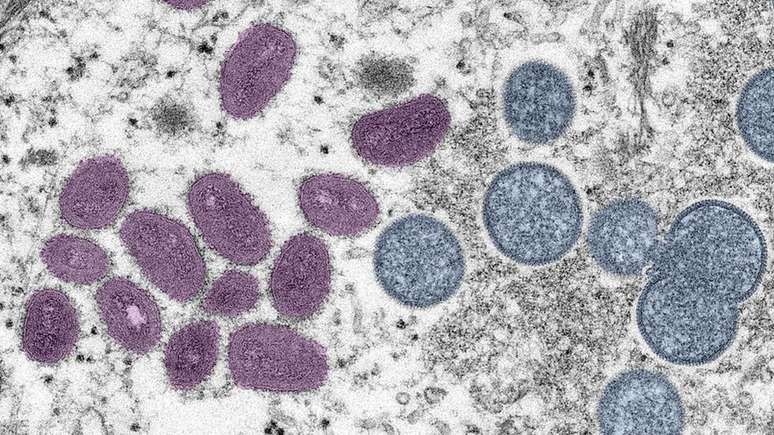 Vírus Monkeypox visto usando microscopia