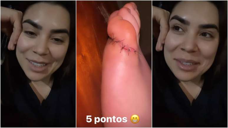 Naiara Azevedo confessou que não sentiu dor após pisar no objeto, mas como tinha muito sangue, resolveu ir para o hospital.