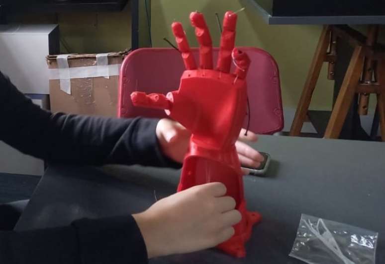 Custo de produ&ccedil;&atilde;o da pr&oacute;tese &eacute; de R$ 600