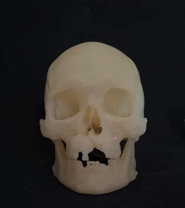 _Impressão 3D do escaneamento de um crânio em exposição no Museu de História da Suécia.