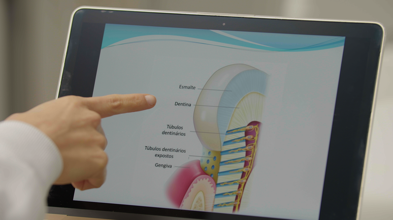 A exposi&ccedil;&atilde;o da dentina, tecido mineralizado dos dentes, causa sensibilidade