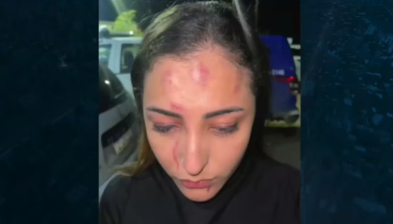 Soraya Oliveira mostra hematomas após sofrer agressão 