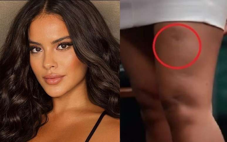 Bella Campos mostra mordida de jacaré