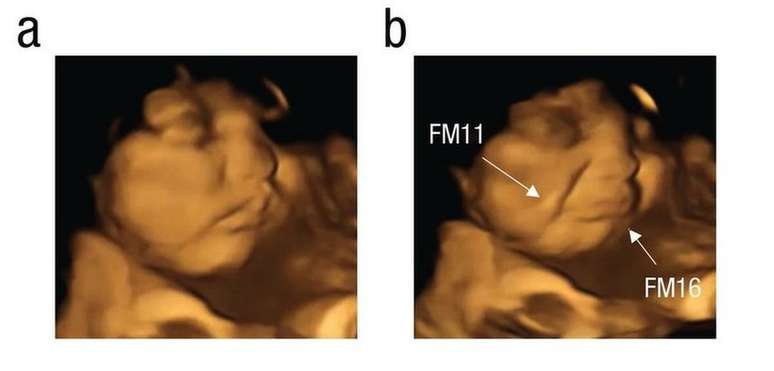 Bebês no útero 'sorriem' para cenouras e 'fazem careta' para couve, dizem  cientistas