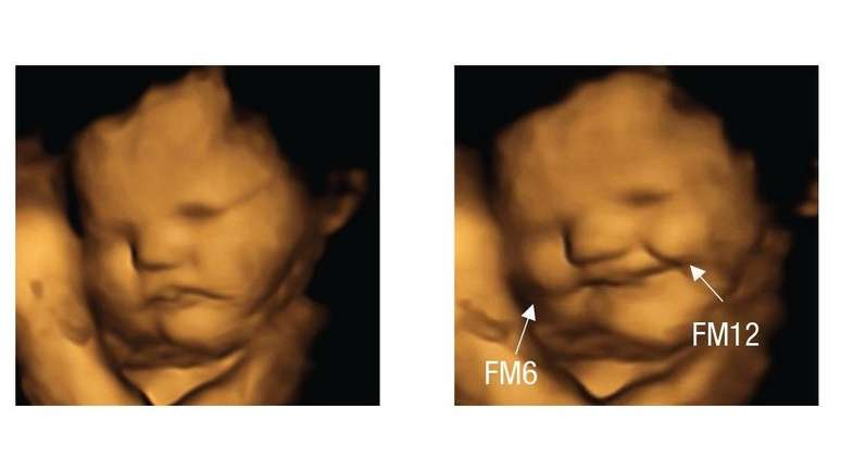 Bebês no útero 'sorriem' para cenouras e 'fazem careta' para couve, dizem  cientistas