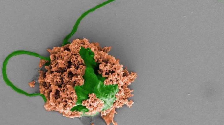 Novos microrrobôs podem navegar no pulmão e administrar medicamentos (Imagem: Zhang et al, 2022/Nature Materials)